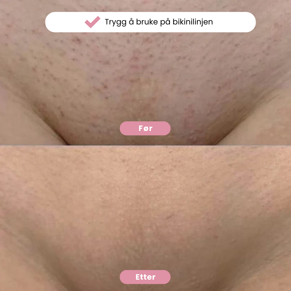 Eulyve™ Bikini-Trimmer