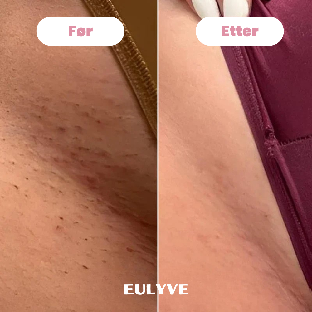 Eulyve™ Bikini-Trimmer