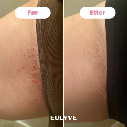 Eulyve™ Bikini-Trimmer