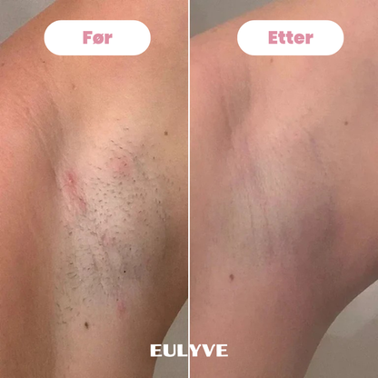 Eulyve™ Bikini-Trimmer